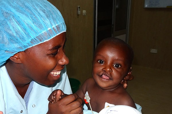 Enfant souffrant d'une fente labiale au Rwanda
