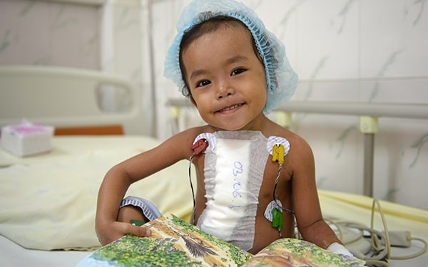 journee mondiale des malformations congenitales la chaine de l espoir
