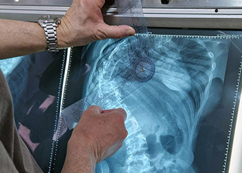 Radiographie d'une colonne vertébrale