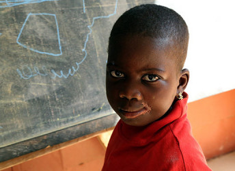 noma enfant sourire