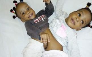 bebes siamoises