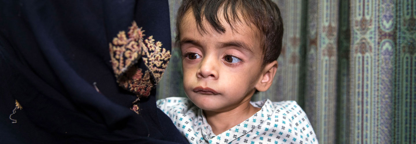 Enfant souffrant de malnutrition en Afghanistan avec sa mère Enfant souffrant de malnutrition en Afghanistan avec sa mère