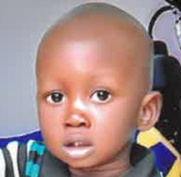 Mariela, open-heart surgery in Madagascar