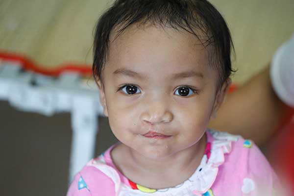 Mariela, open-heart surgery in Madagascar