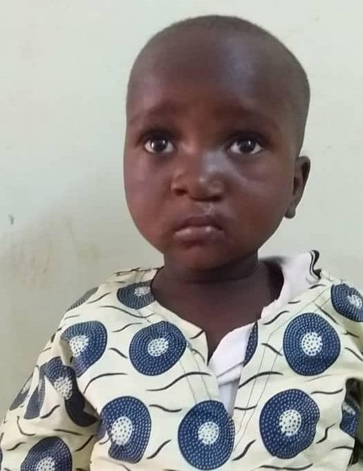 Mariela, open-heart surgery in Madagascar