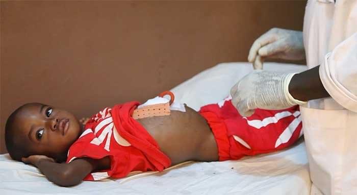 Mariela, open-heart surgery in Madagascar