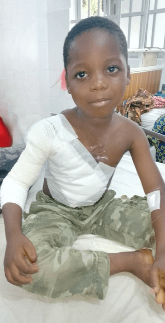 Ernest after his operation during a surgical mission of La Chaîne de l&apos;Espoir in Benin.