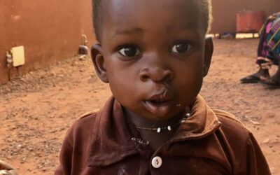 Enfant ayant été opéré d'une pathologie maxillo-faciale