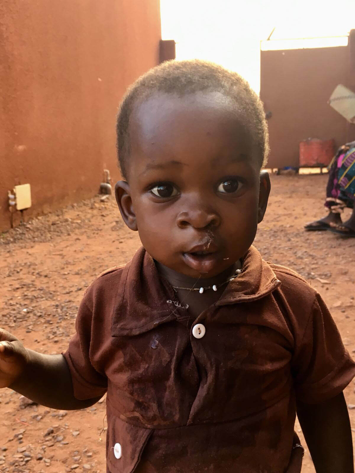 Enfant ayant été opéré d'une pathologie maxillo-faciale